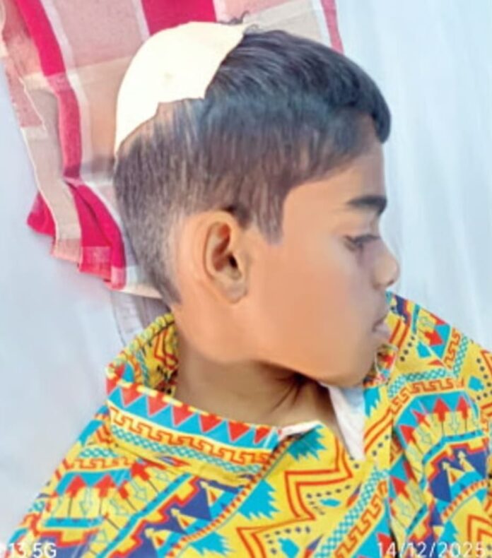 डोक्यात भाला घुसल्याने विद्यार्थी गंभीर जखमी